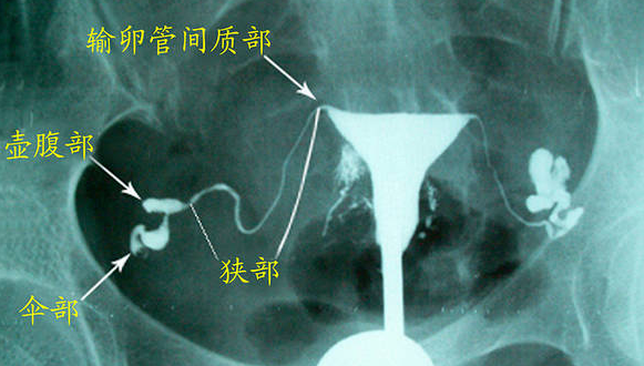 图片1